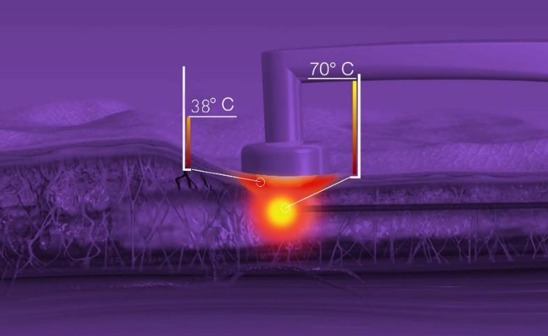 Temperatura interna e externa